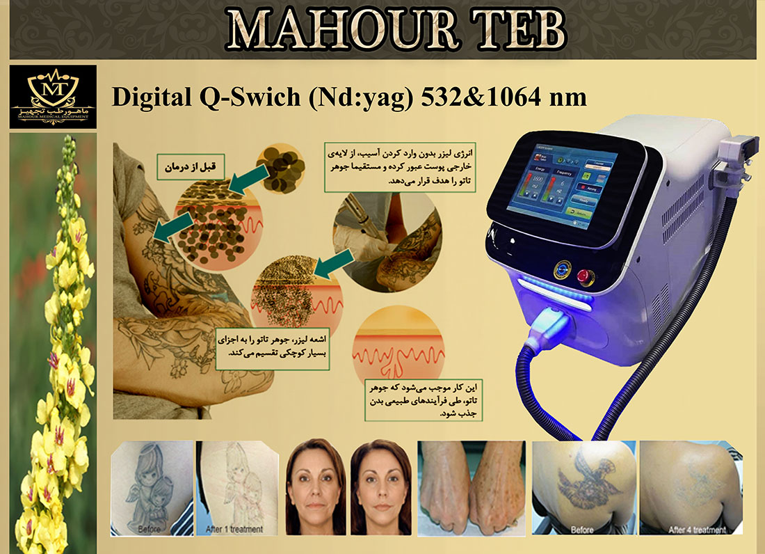 کاتالوگ دستگاه لیزر کیوسوئیچ دیجیتالی 01